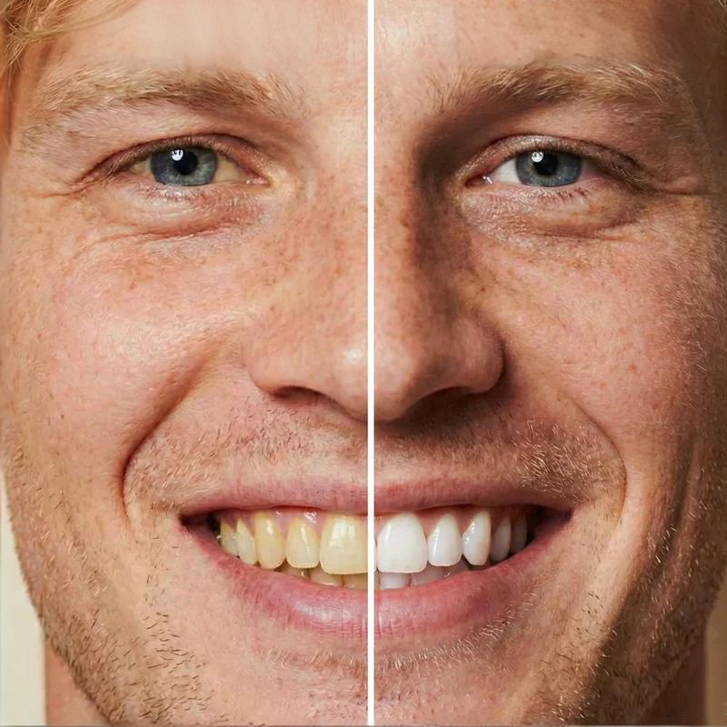 🧴Instant Whitening Tooth Paint😁🦷