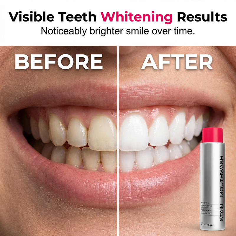 Advanced Stain-Removing Whitening Mouthwash